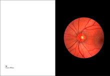 Load image into Gallery viewer, Interior of Elad Lassry&#39;s &quot;On Onions,&quot; with photograph of retina.