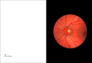 Interior of Elad Lassry's "On Onions," with photograph of retina.